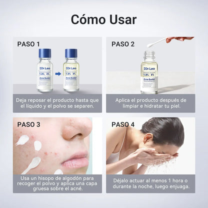 Dr. Leo Loción Secante de Acné 4 en 1 | Ayuda a Mejorar la Apariencia de Imperfecciones | Contribuye a Secar Granos Rápidamente, Controlar Brillo, Afinar Poros y Suavizar Marcas | Ideal para Piel Sensible – 10ml