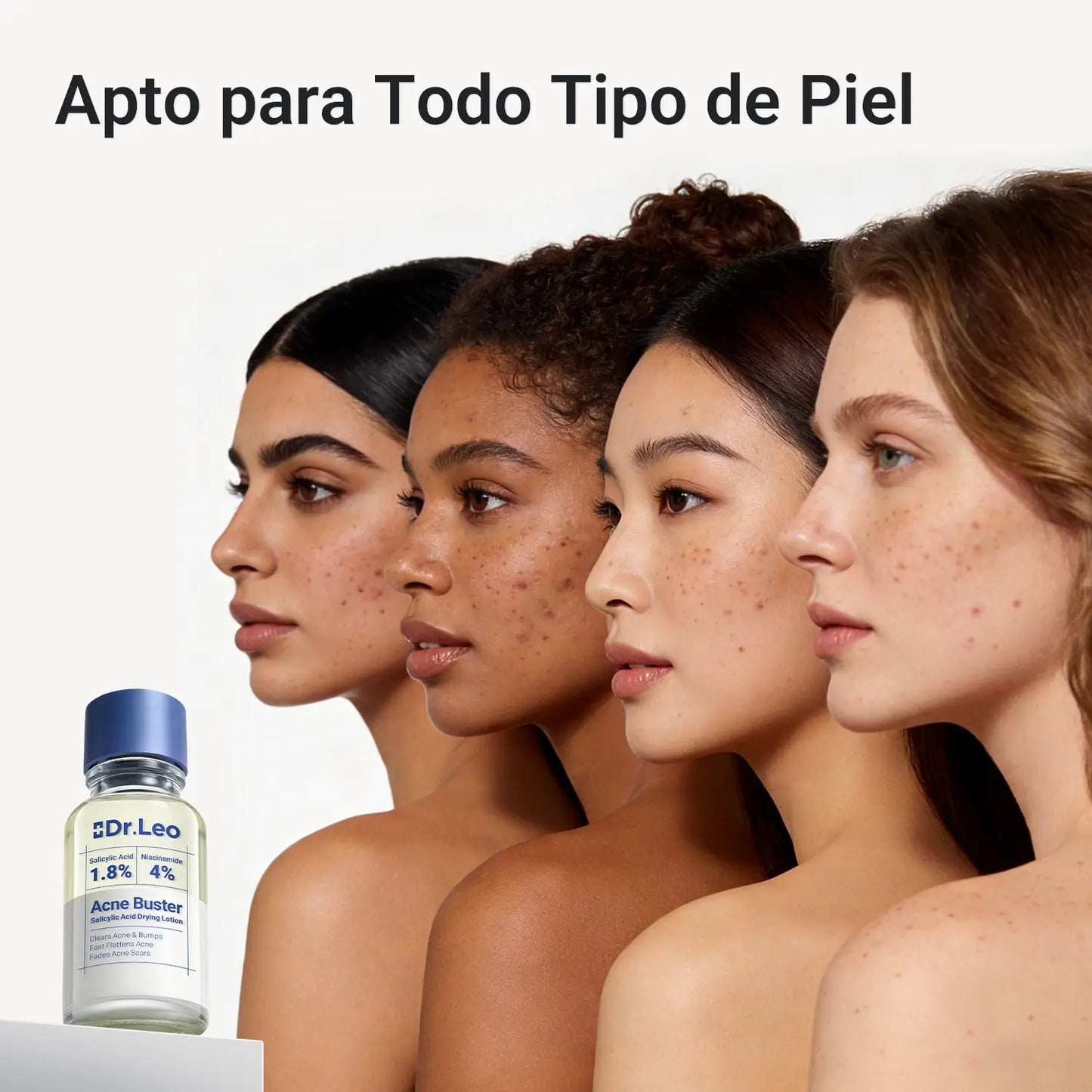 Dr. Leo Loción Secante de Acné 4 en 1 | Ayuda a Mejorar la Apariencia de Imperfecciones | Contribuye a Secar Granos Rápidamente, Controlar Brillo, Afinar Poros y Suavizar Marcas | Ideal para Piel Sensible – 10ml